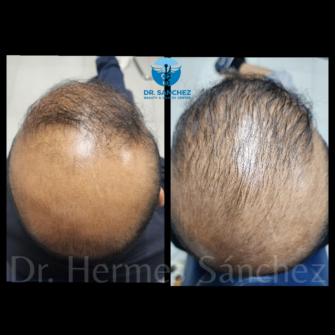 Galería - Transformación 6